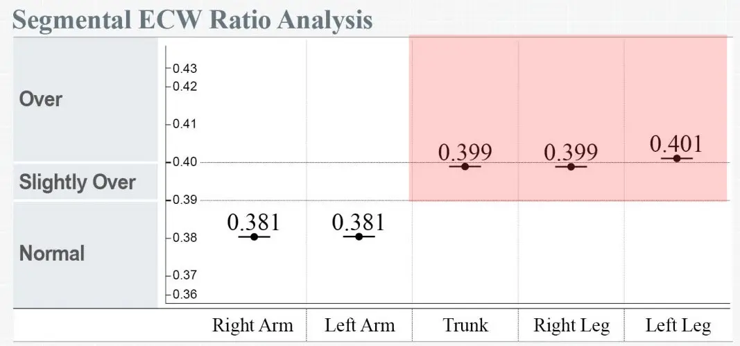 InBody Segmental ECW Ratio