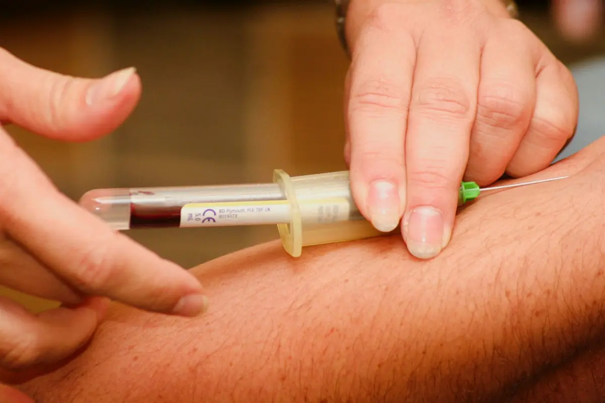 Underlying condition that could affect Phase Angle
