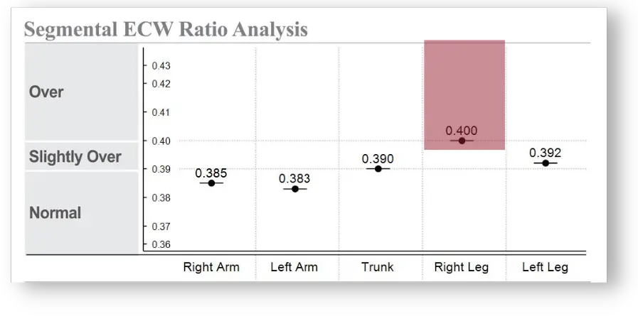 Segmental ECW Ratio in InBody Results