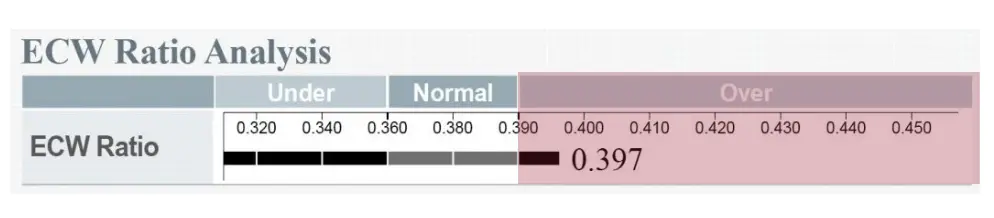 ECW Ratio in InBody