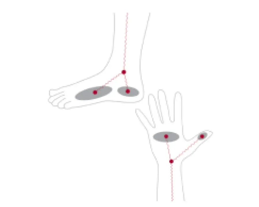 8-Point Tactile Electrode System with Thumb Electrodes