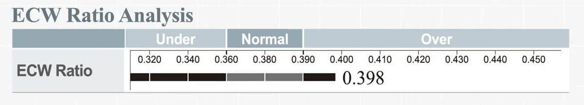ECW Ratio