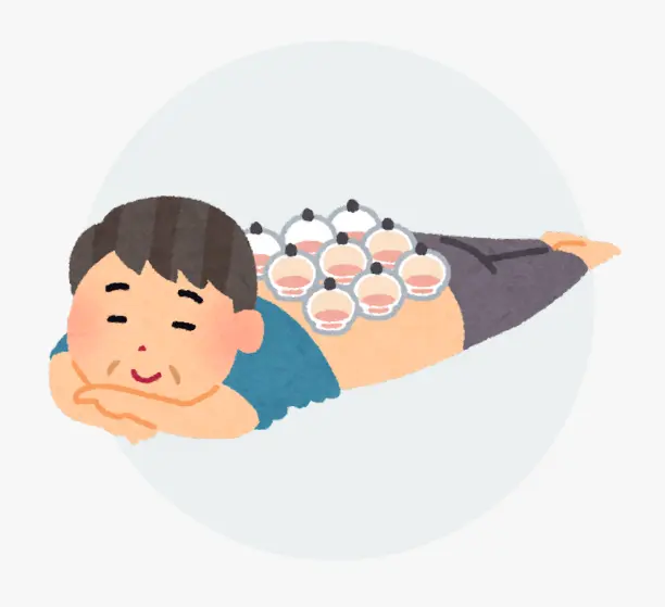 Cupping