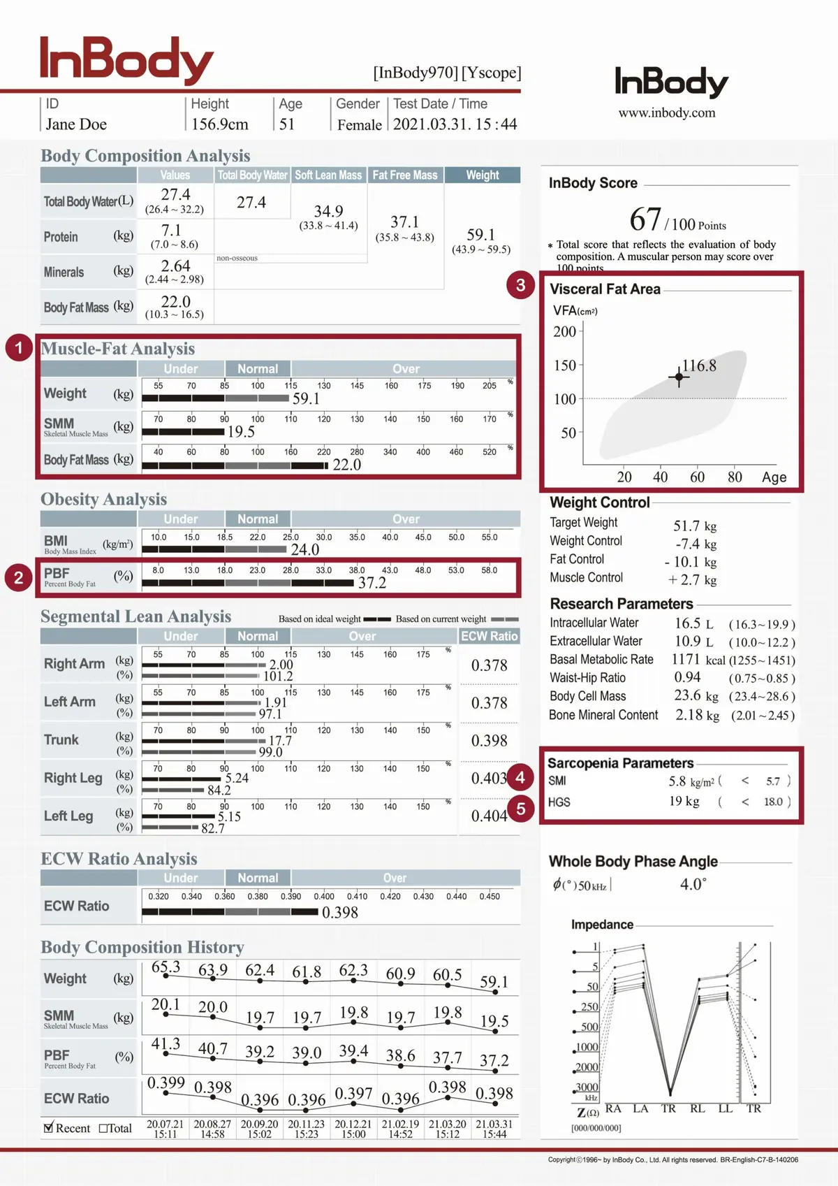 InBody in Screening Sarcopenic Obesity