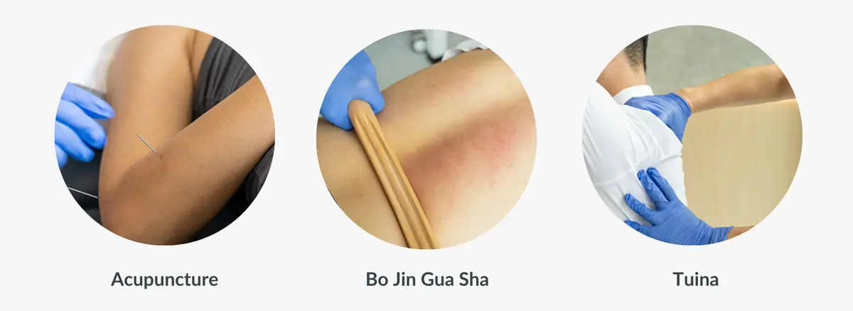 Traditional Chinese Medicine Therapies like acupuncture, gua sha and tuina