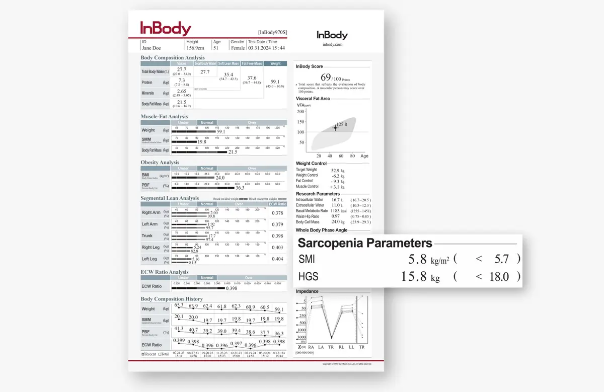 Sarcopenia Parameters on InBody Result Sheet
