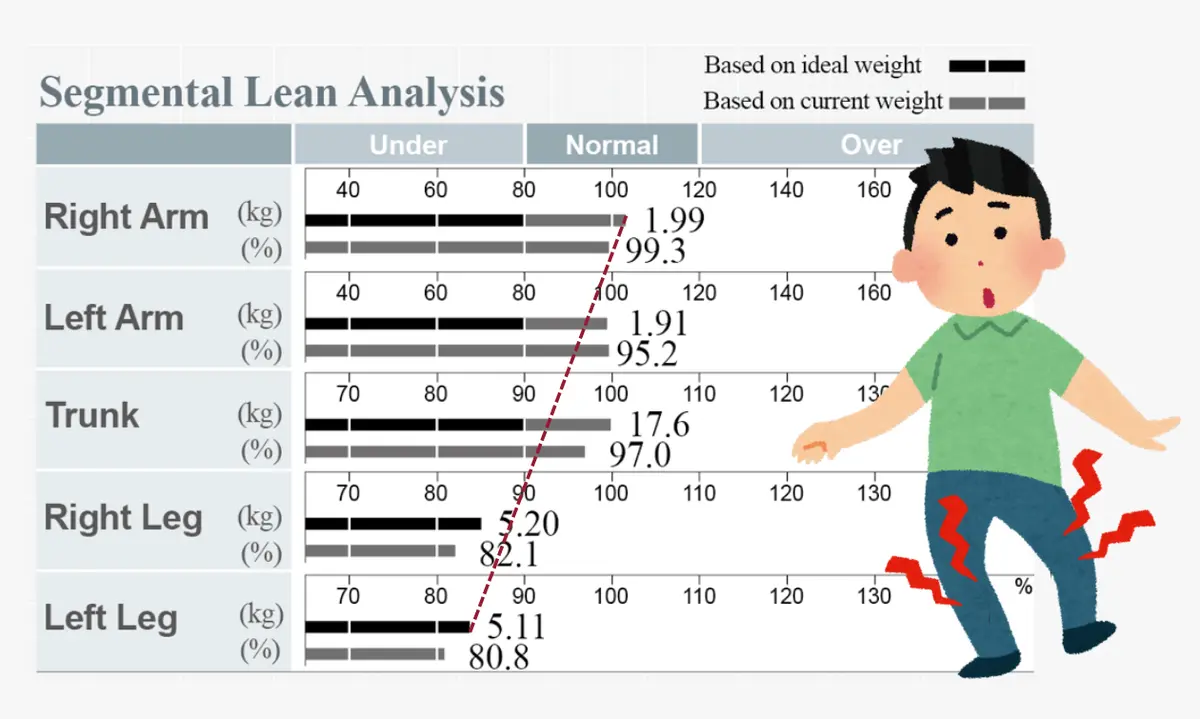 Segmental Lean Analysis identifying muscle imbalances or weakness