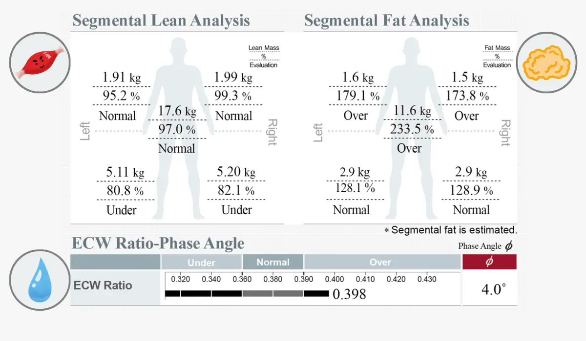 InBody Result Sheet showing Segmental Lean & Fat Analysis and ECW Ratio