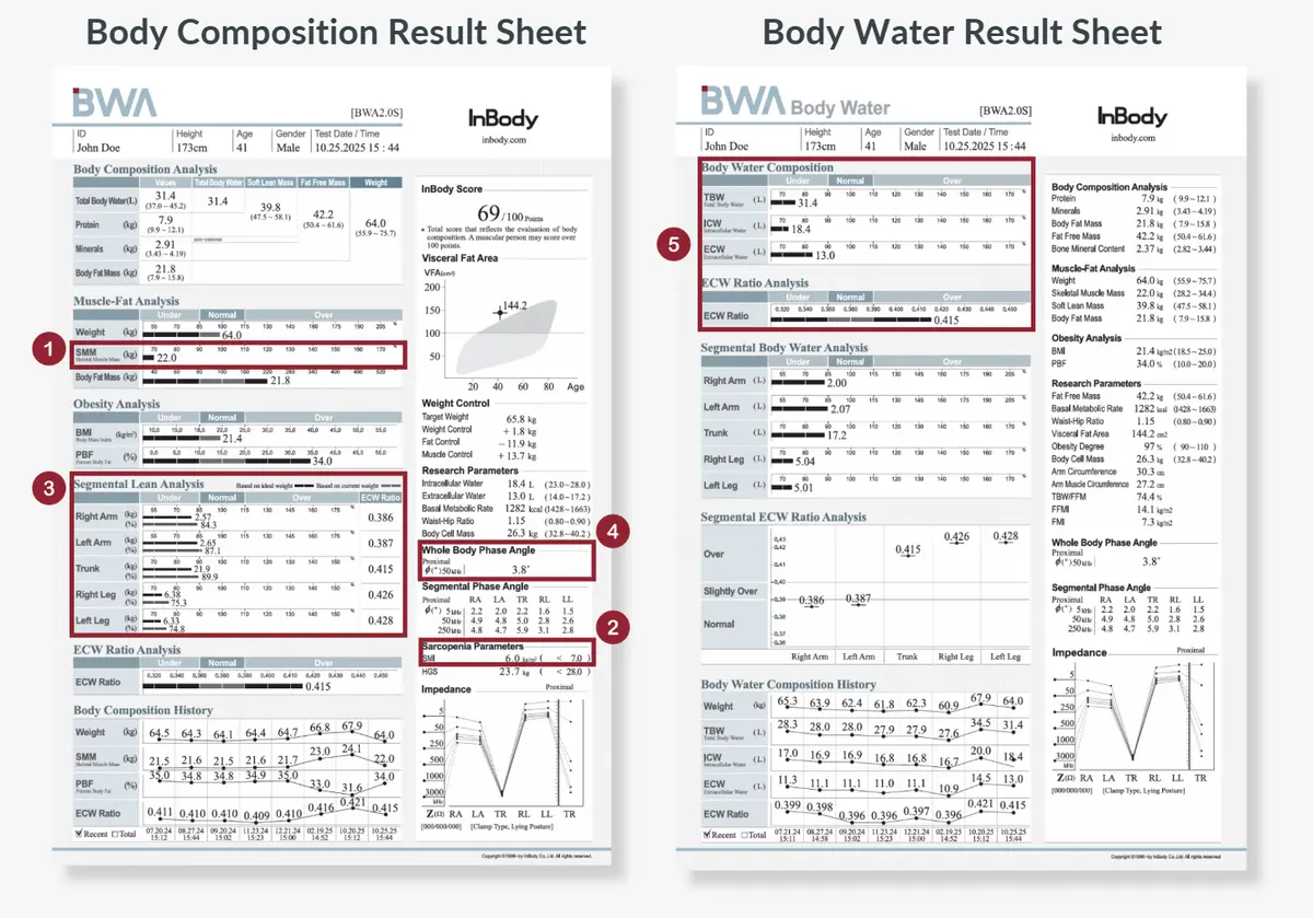 Key InBody Parameters Supporting GLIM Assessment