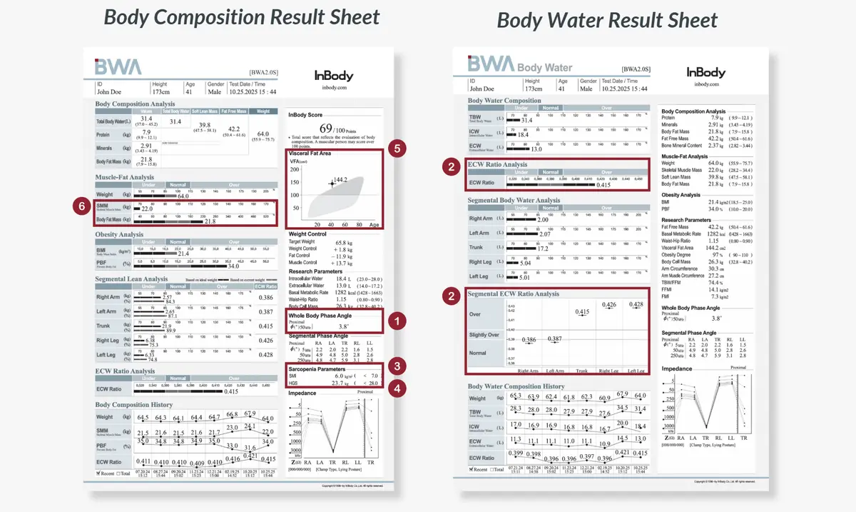 BWA2.0S Body Composition Result Sheet and Body Water Result Sheet